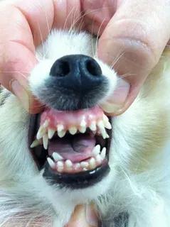 Лишние зубы